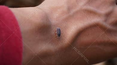 woodlice crawling onto human hands