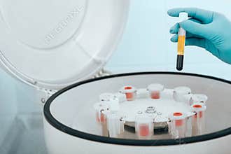 Blood samples in vials on a centrifuge machine close-up. Hematology