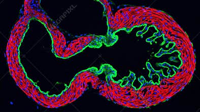 Embryonic Heart Loop Stage Trabeculation Confocal