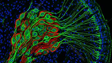 Spiral Ganglion Neuron Type I Type II Cochlea