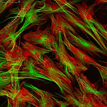 Fibroblasts (skin cells) labeled with fluorescent dyes