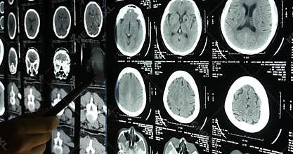 4k Doctors study skull brain X-ray film for analysis.health medical hospital.