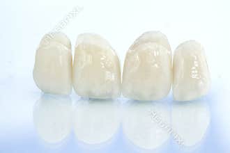 Metal free ceramic dental crowns