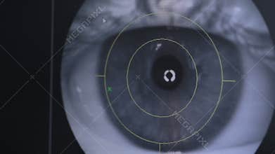 Close up of an eye examination. Doctors screen view. Medical attendance at the optometrist in a bright modern clinic.