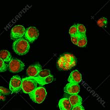 Real fluorescence microscopic view of human neuroblastoma cells