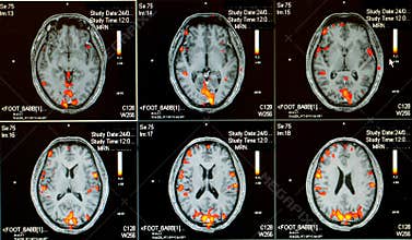 Human active brain imaging