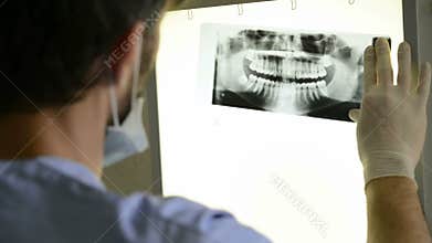 Dental x-ray