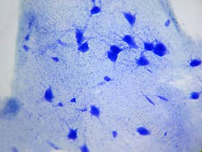 Nerve cells