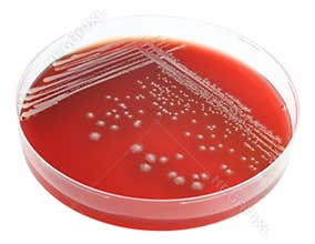 Mold