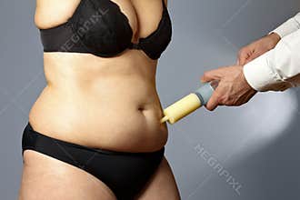 Rotund woman liposuction belly syringe
