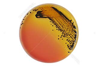 Black bacterial colonies of Salmonella species on Salmonella Shigella agar (SS agar, selective and differential medium) plate on