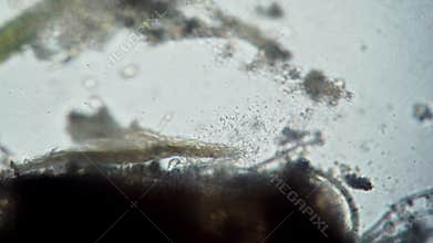 A large colony of bacteria on a dust mite trum microcosm background