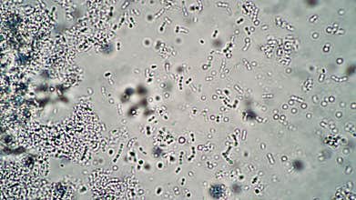 A lot of bacteria and bacilli in a drop of ferment for fermented milk