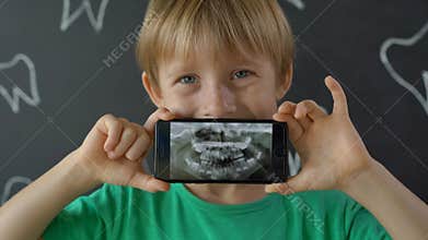 Closeup shot of a little boy with missing milk teeth showing his x-ray dental picture. Concept of children tooth change