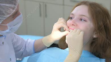 Orthodontist doctor puts silicone invisible transparent braces in girl`s teeth.
