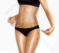 Body of woman for correction cosmetic surgery