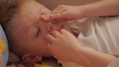 A sad little boy with chickenpox is lying on the bed with a lot of red blisters.