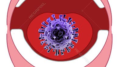 Closeup or macro shot infected by bacteria kid or children tongue disease bacterium
