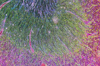 Microscopic section of human kidney