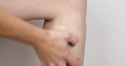 hand combing leg with varicose vein, itching in the sore leg