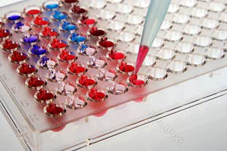 Microplates test
