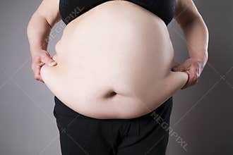 Obesity female body, fat woman belly close up