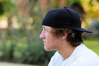 Teenage boy with acne and backwards baseball hat looking sideways