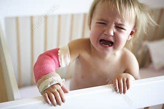 Crying Toddler With Arm In Cast