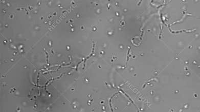 Yeast cells