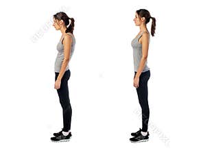 Woman with impaired posture position defect