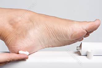 Dry feet
