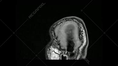 MRI Brain Sagittal Navigation