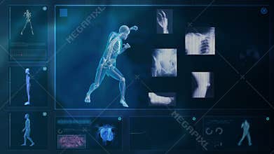 Computer X-raying human body