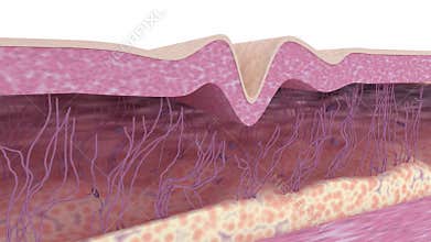 Wrinkle smoothing process. Medical 3d animation.