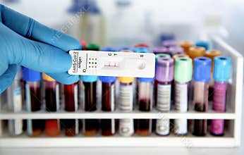Antigen test kit for SARS‑CoV‑2 self testing