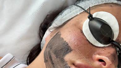 Young woman getting carbon laser facial at beauty clinic. Professional skincare