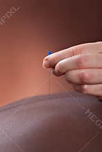 Woman receiving acupuncture treatment at salon