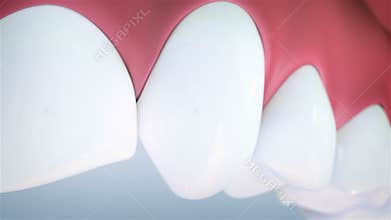 Teeth cleaning