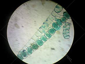 Spirogyra conjugation