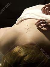 Acupuncture Concept
