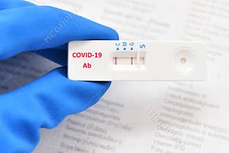 COVID-19 IgG antibody positive