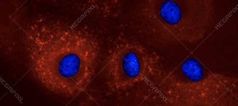 Research on Sars-Cov-2 vaccine: coronavirus infected Vero cells reacting to antibodies raised against nsp and structural proteins
