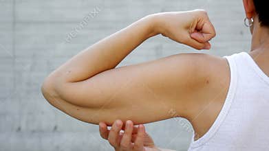 A faceless  woman shows the flabby muscles of the arm