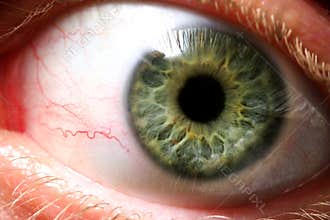 Evil eye