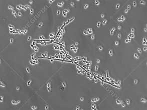 Stock Photograph of Candida albicans