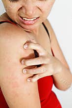 Woman scratch itchy arm