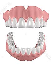 Dentures