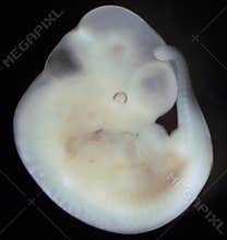 Mouse embryo, day 11 of development