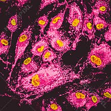 Mitochondria staining