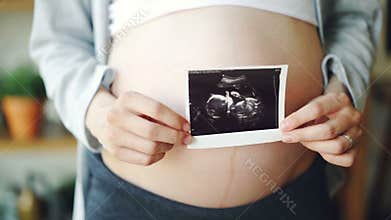 Close-up shot of pregnant woman`s belly and female hands holding ultrasound image of healthy unborn child. Pregnancy